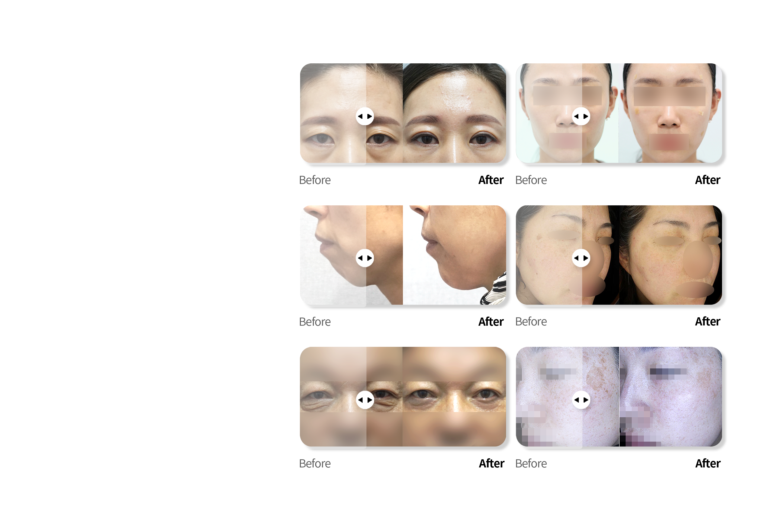 불당점 케이스 전후사진